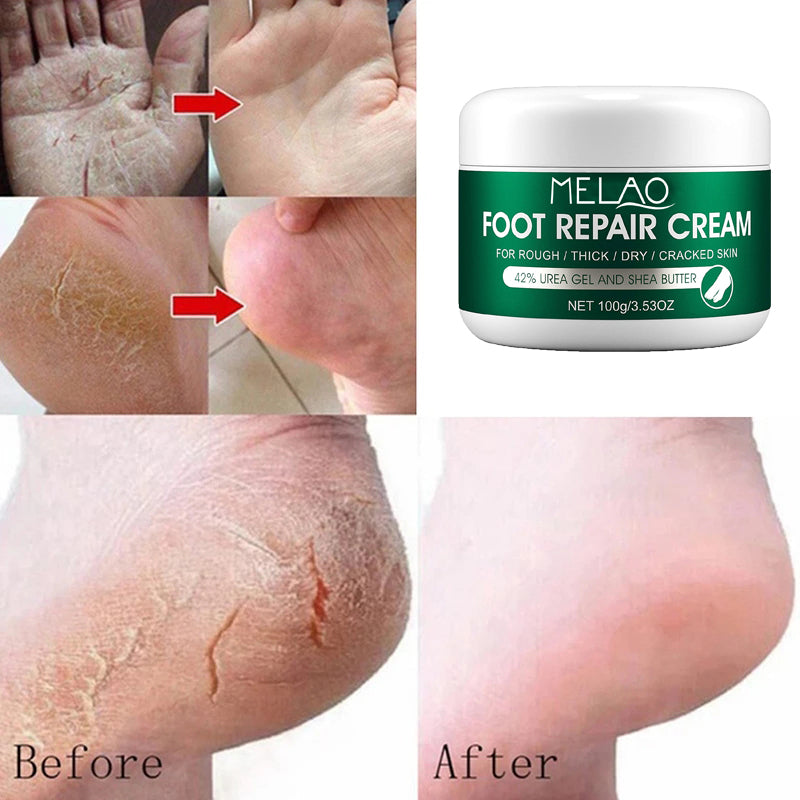 REMOVEDOR CELULAR PODOLOGICO UREA 40%