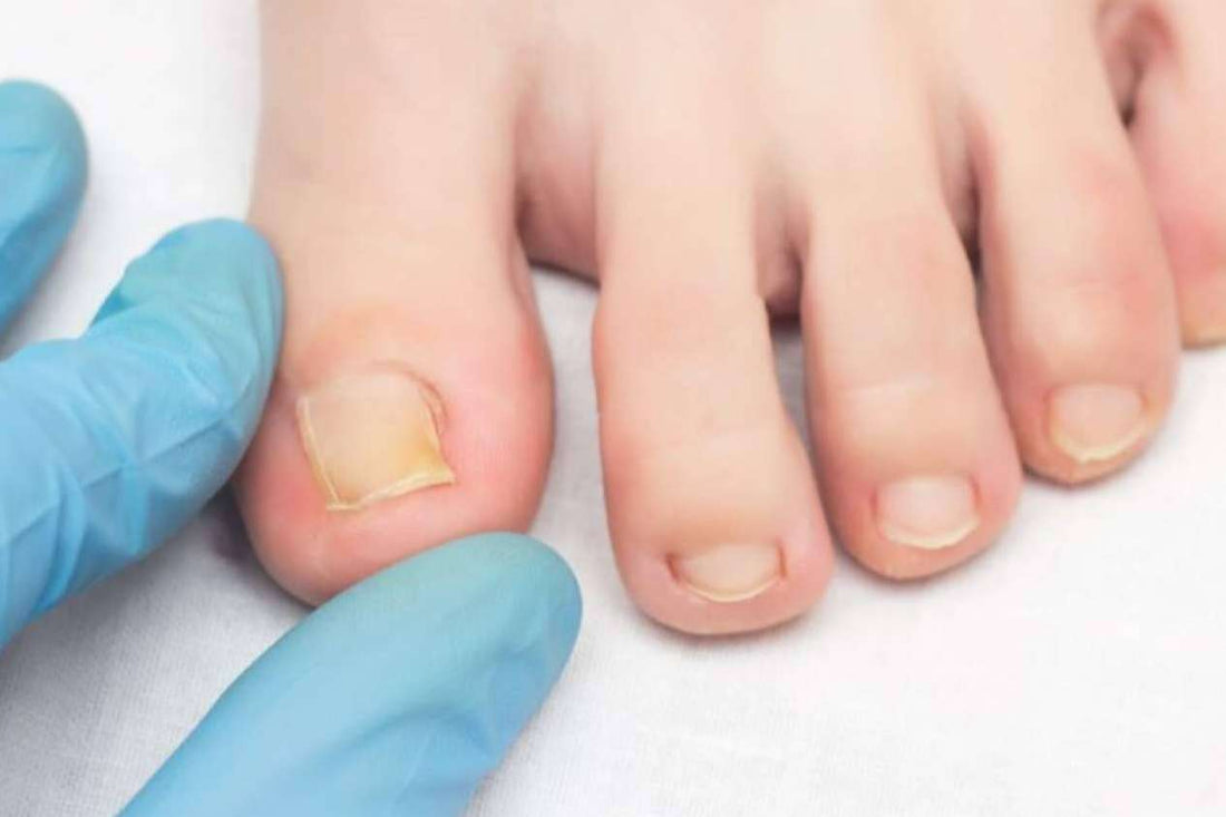 Paquete Podológico Integral Diagnostico, Limpieza Micosis Corte Pulido Callos