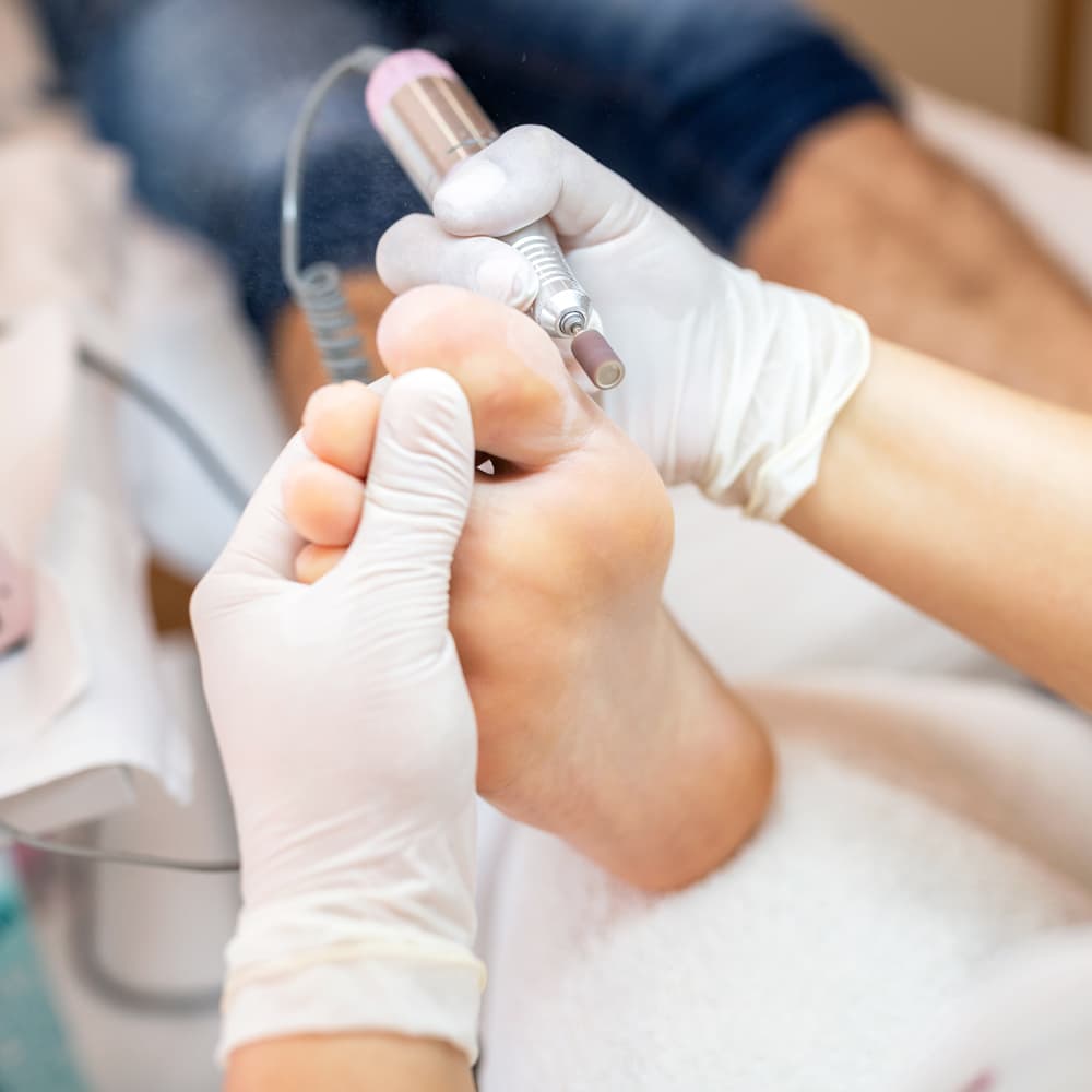 Paquete Básico Servicio Podologico, Corte, Limpieza, Callos, Hidratacion, Exfoliacion De Uñas