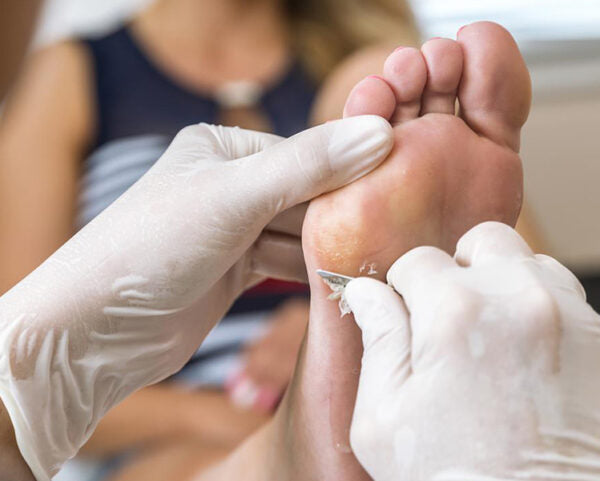 Paquete Podológico Integral Diagnostico, Limpieza Micosis Corte Pulido Callos